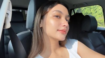 Bí quyết dưỡng ẩm cho da dầu để giảm mụn đầu đen, mụn trứng cá